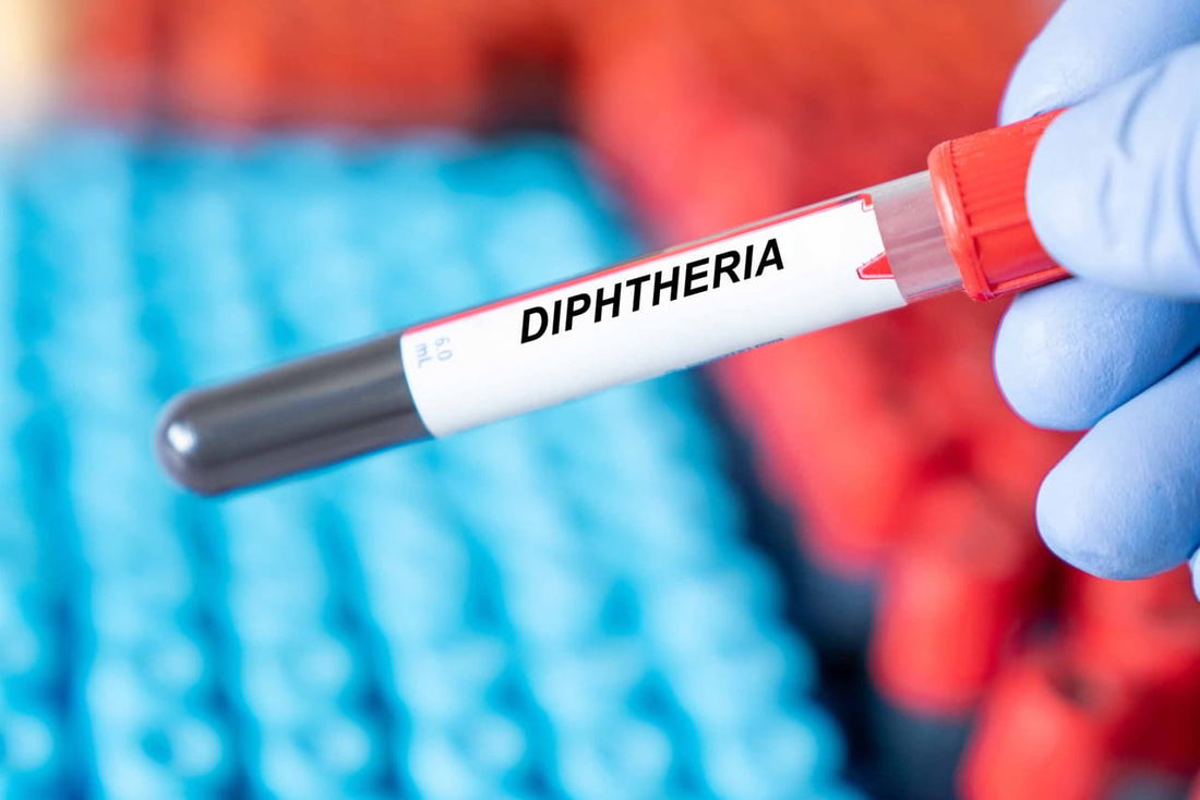 Diphtheria Symptoms, Signs, Causes, Treatment & Prevention
