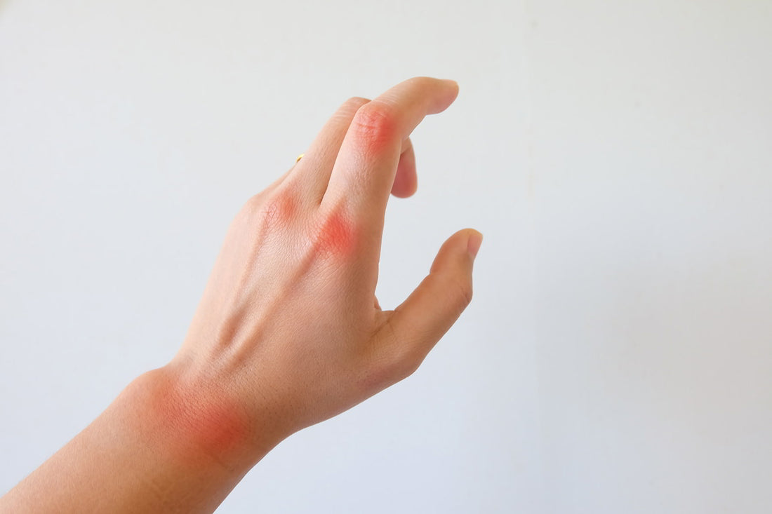 5 Simple Ways to Cure Osteoarthritis Pain in Fingers Joints