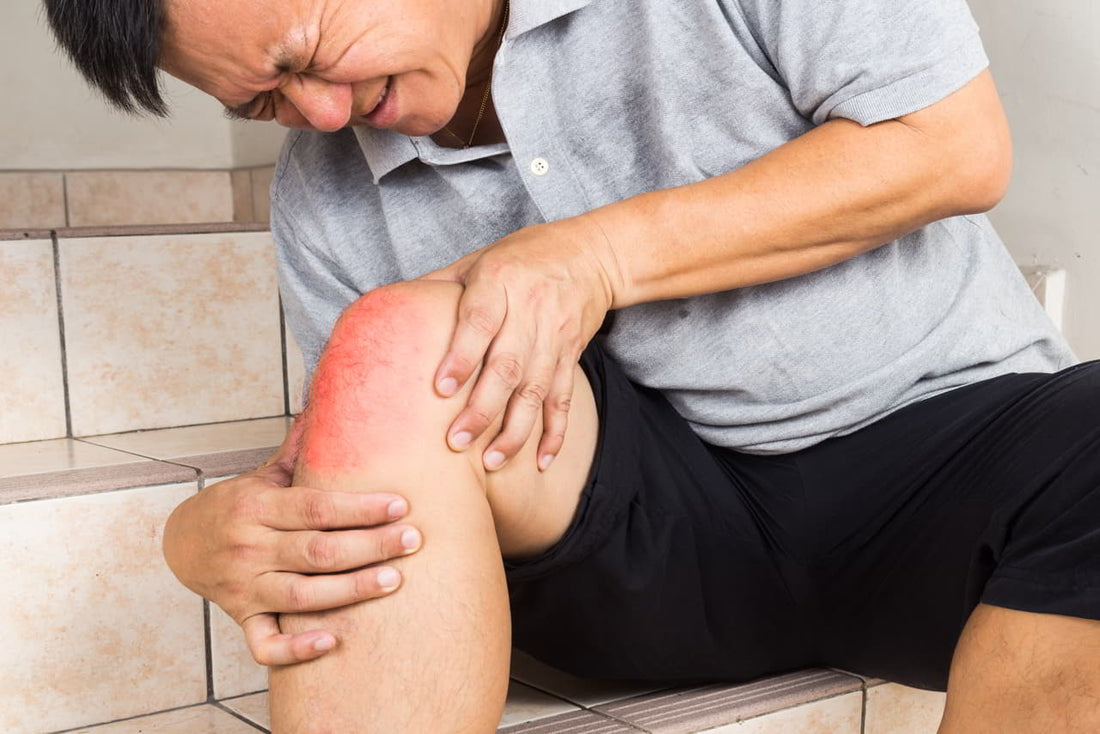 Stiff Joints? 5 Must-Have Home Remedies For Osteoarthritis
